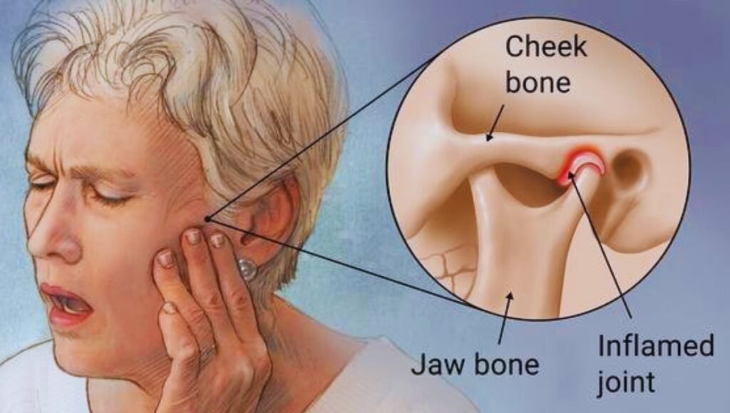 Can a Broken Tooth Cause Jaw Pain