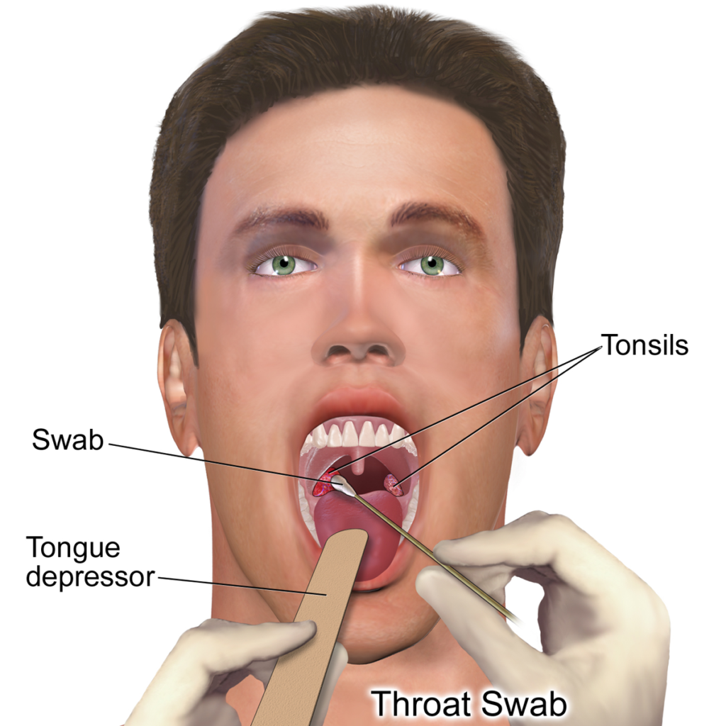 Can a Infected Tooth Cause Dizziness